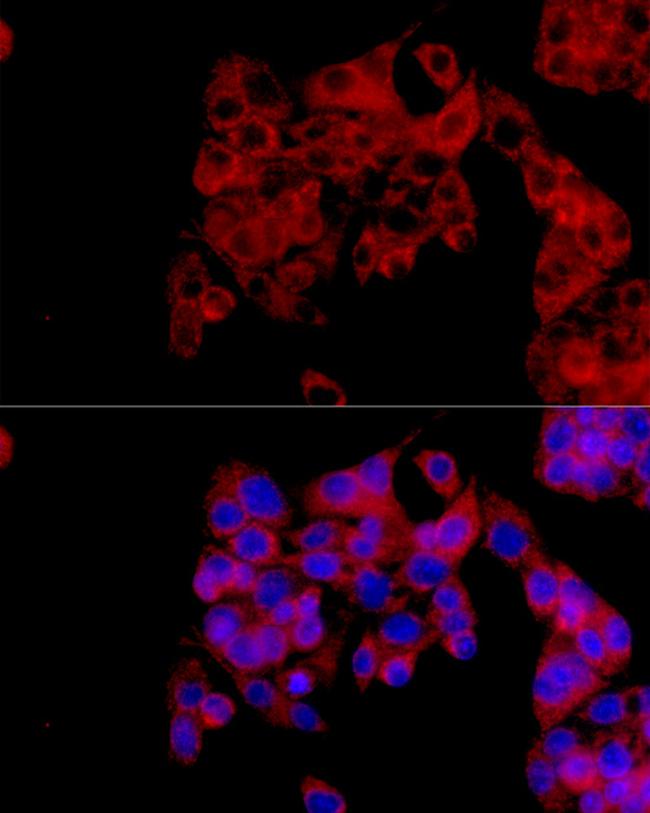 IL1RA Antibody in Immunocytochemistry (ICC/IF)