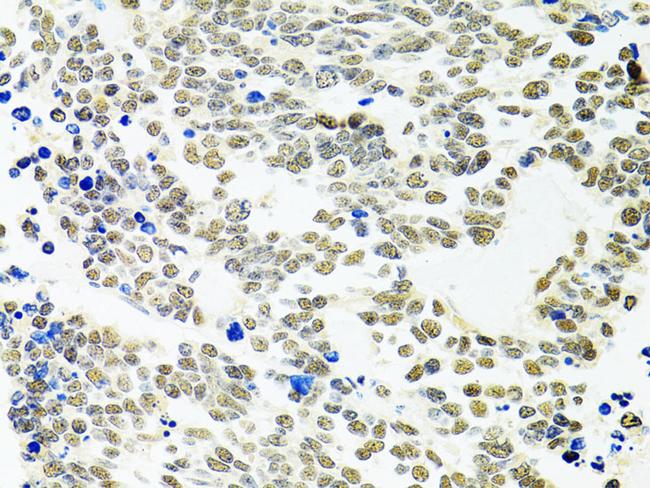 PPP4C Antibody in Immunohistochemistry (Paraffin) (IHC (P))