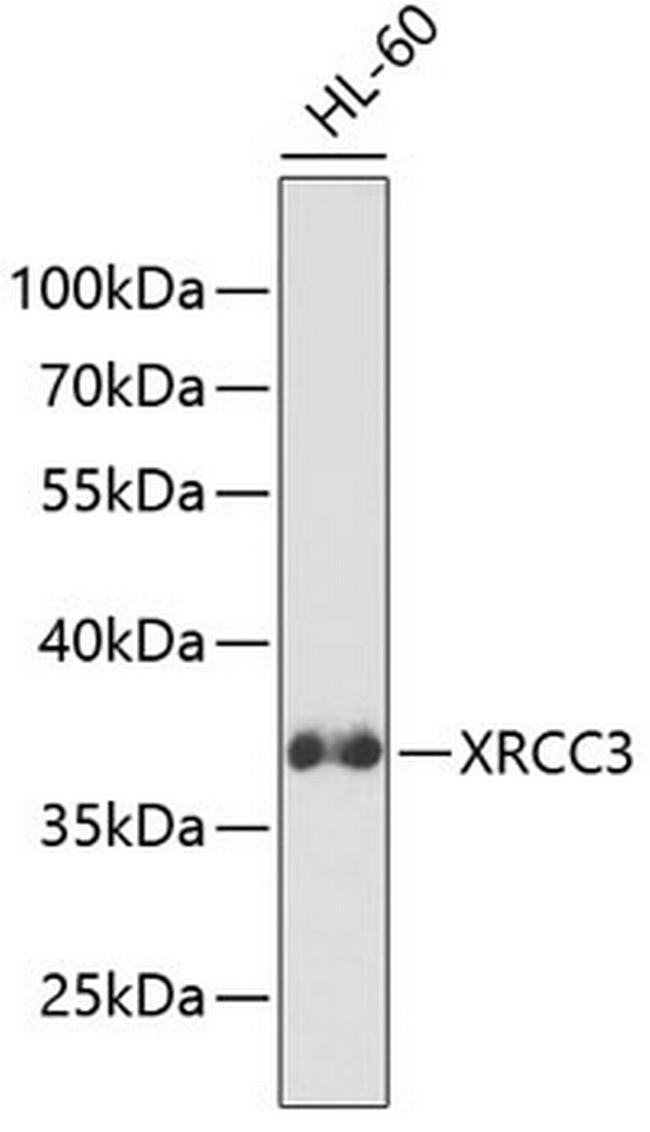 XRCC3 Antibody in Western Blot (WB)