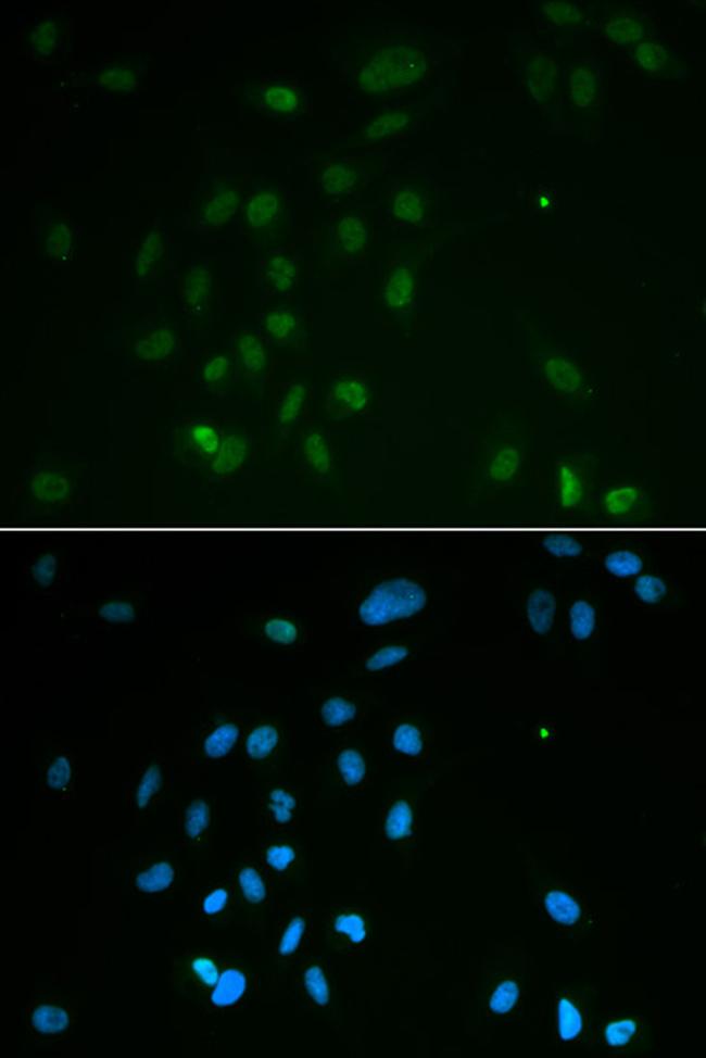 CHK2 Antibody in Immunocytochemistry (ICC/IF)