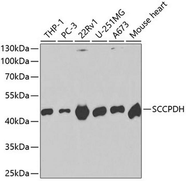 SCCPDH Antibody in Western Blot (WB)