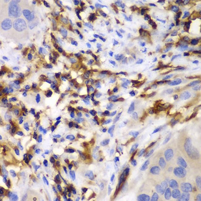 HCLS1 Antibody in Immunohistochemistry (Paraffin) (IHC (P))