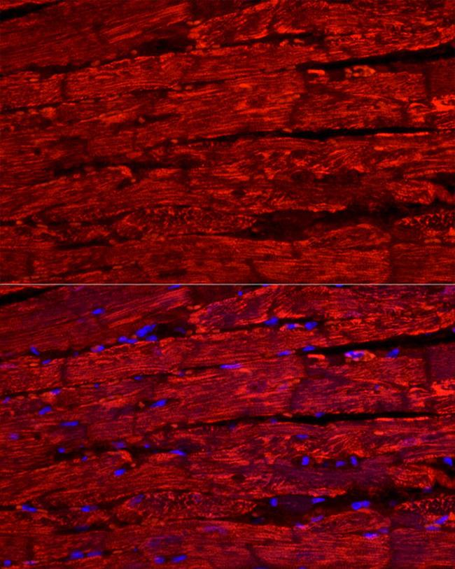 BNP Antibody in Immunocytochemistry (ICC/IF)