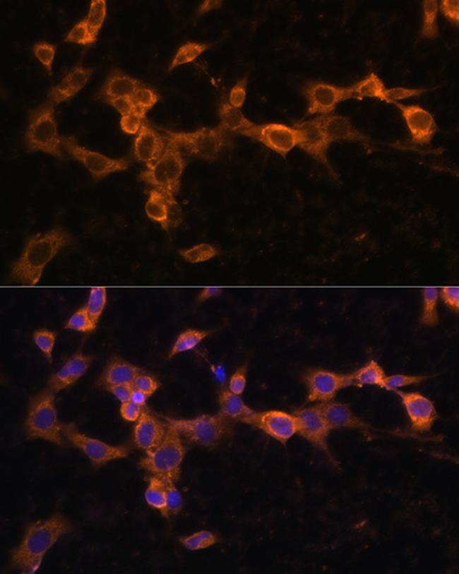 PDGFRB Antibody in Immunocytochemistry (ICC/IF)