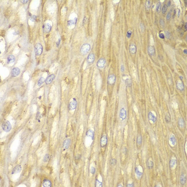 PPP2R2A Antibody in Immunohistochemistry (Paraffin) (IHC (P))