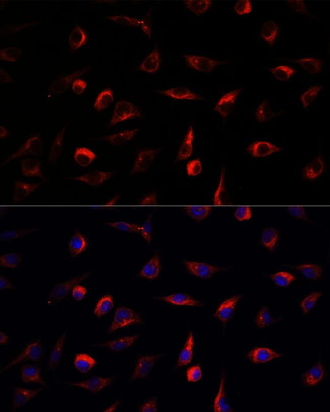 MEK7 Antibody in Immunocytochemistry (ICC/IF)