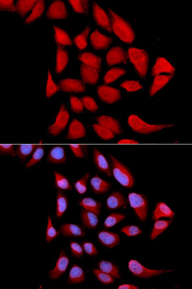 PSMA6 Antibody in Immunocytochemistry (ICC/IF)