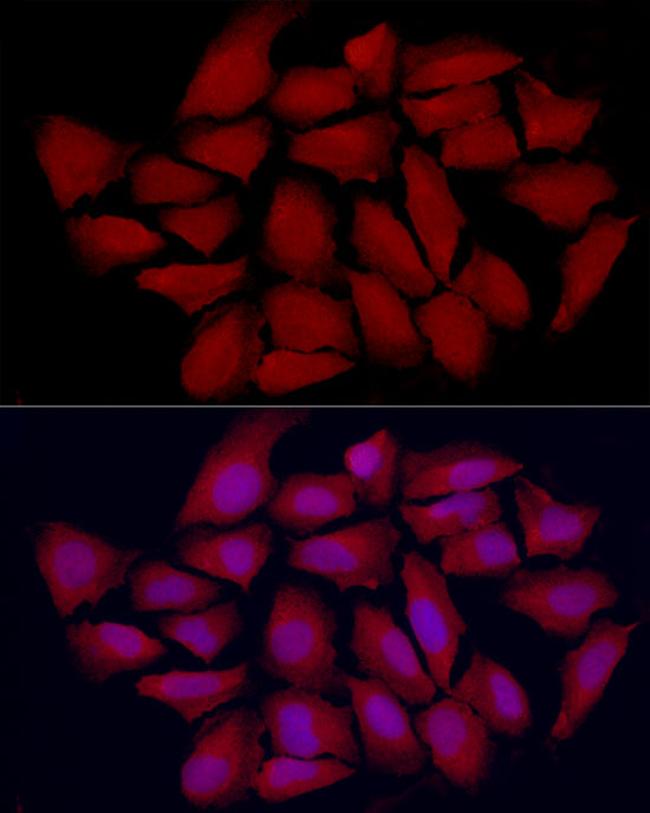 VDR Antibody in Immunocytochemistry (ICC/IF)