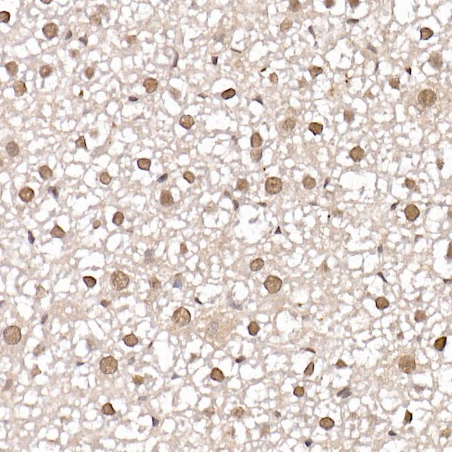 PRMT4 Antibody in Immunohistochemistry (Paraffin) (IHC (P))