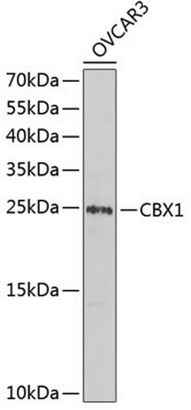 HP1 beta Antibody in Western Blot (WB)