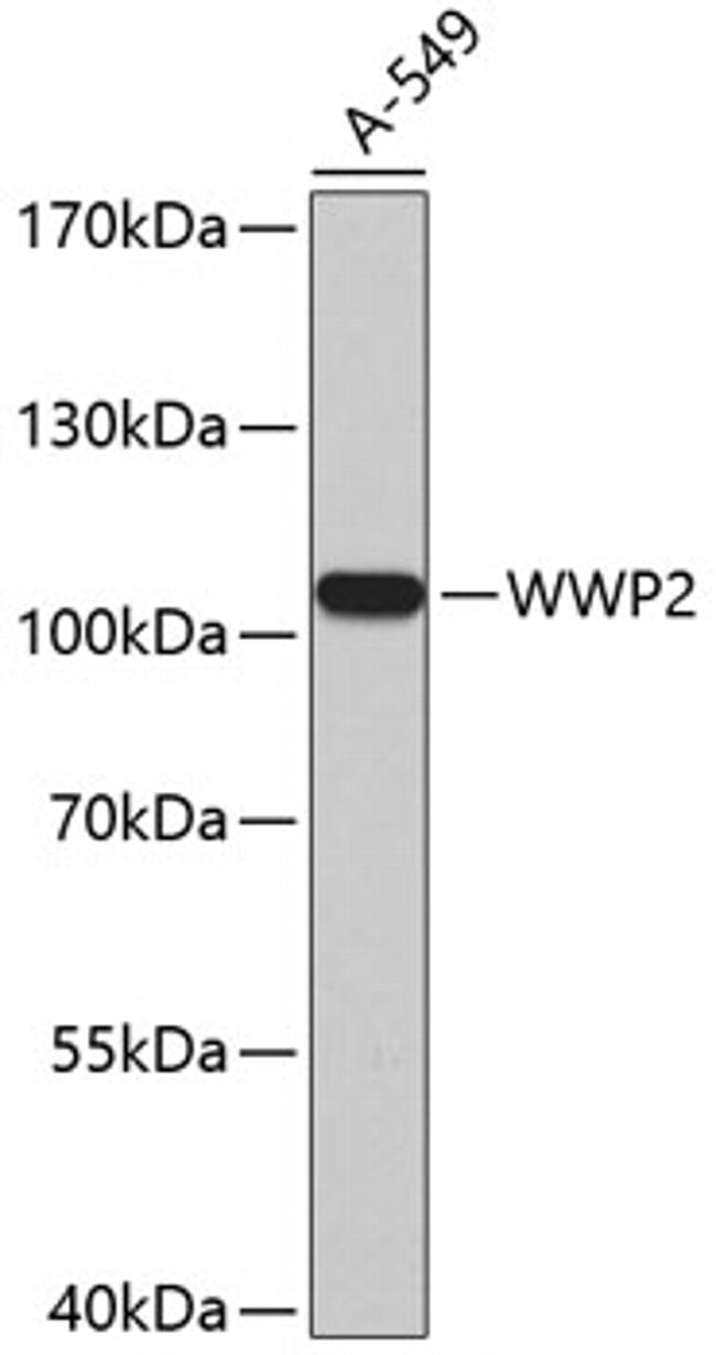 AIP2 Antibody in Western Blot (WB)