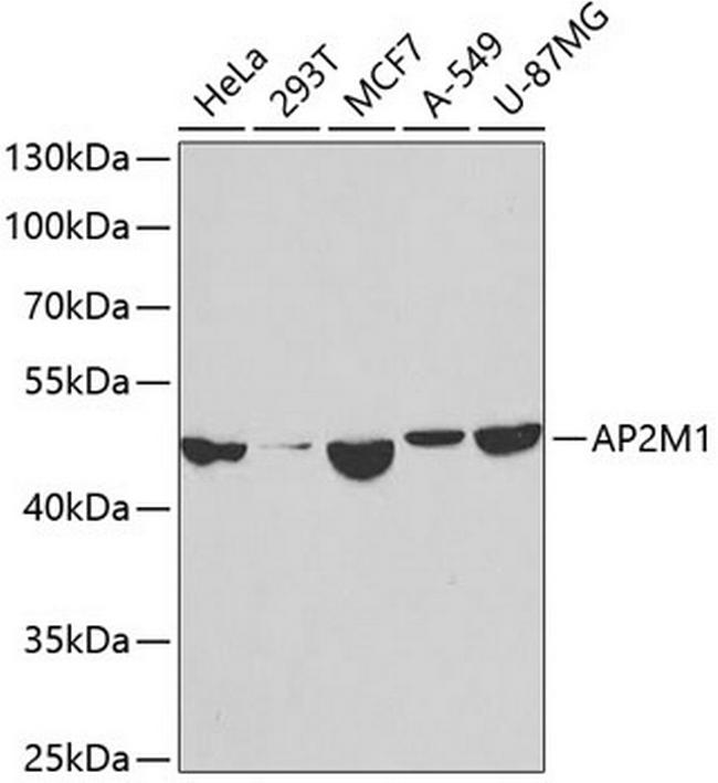 AP2M1 Antibody in Western Blot (WB)