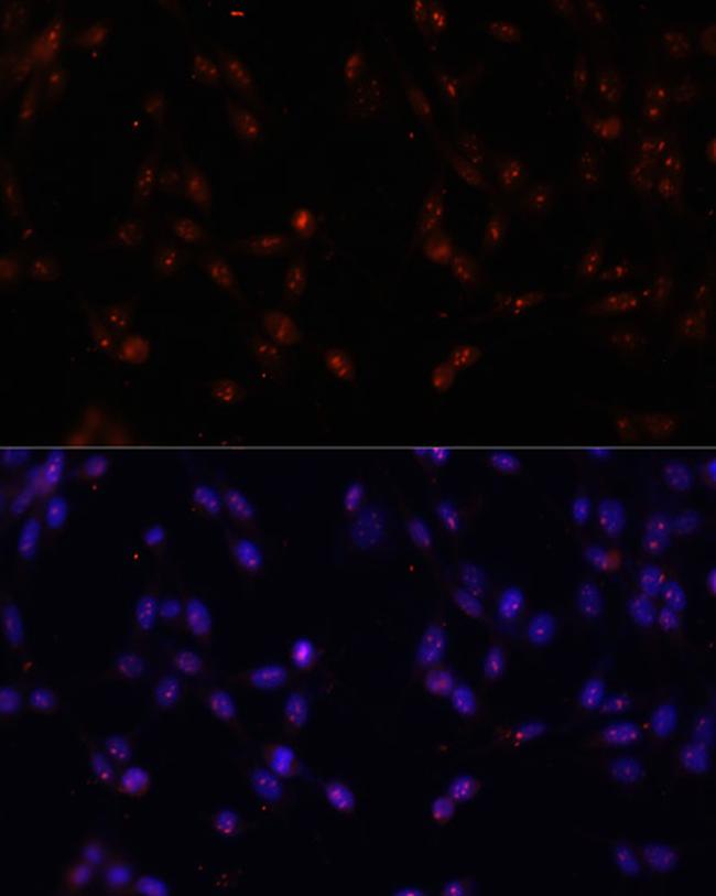 ILF3 Antibody in Immunocytochemistry (ICC/IF)