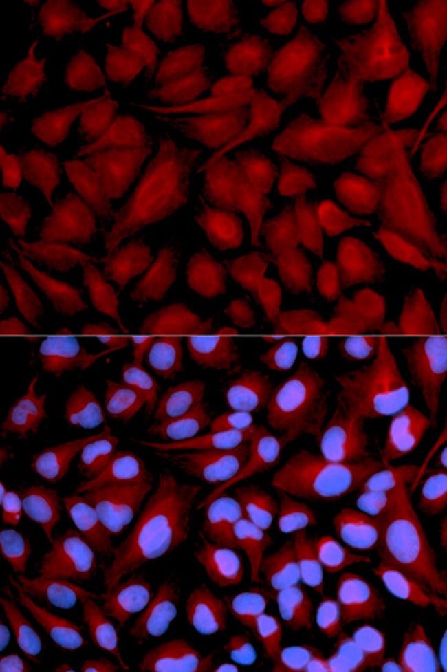 CASK Antibody in Immunocytochemistry (ICC/IF)