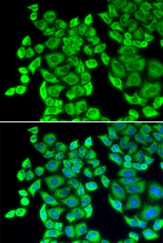 EEF1D Antibody in Immunocytochemistry (ICC/IF)