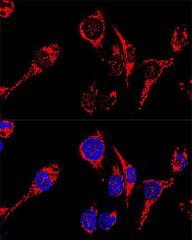 AIF Antibody in Immunocytochemistry (ICC/IF)