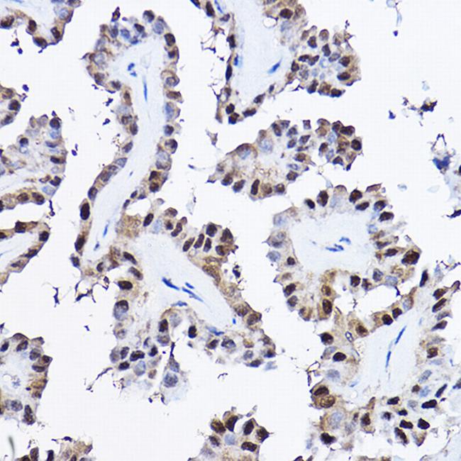 PDCD4 Antibody in Immunohistochemistry (Paraffin) (IHC (P))