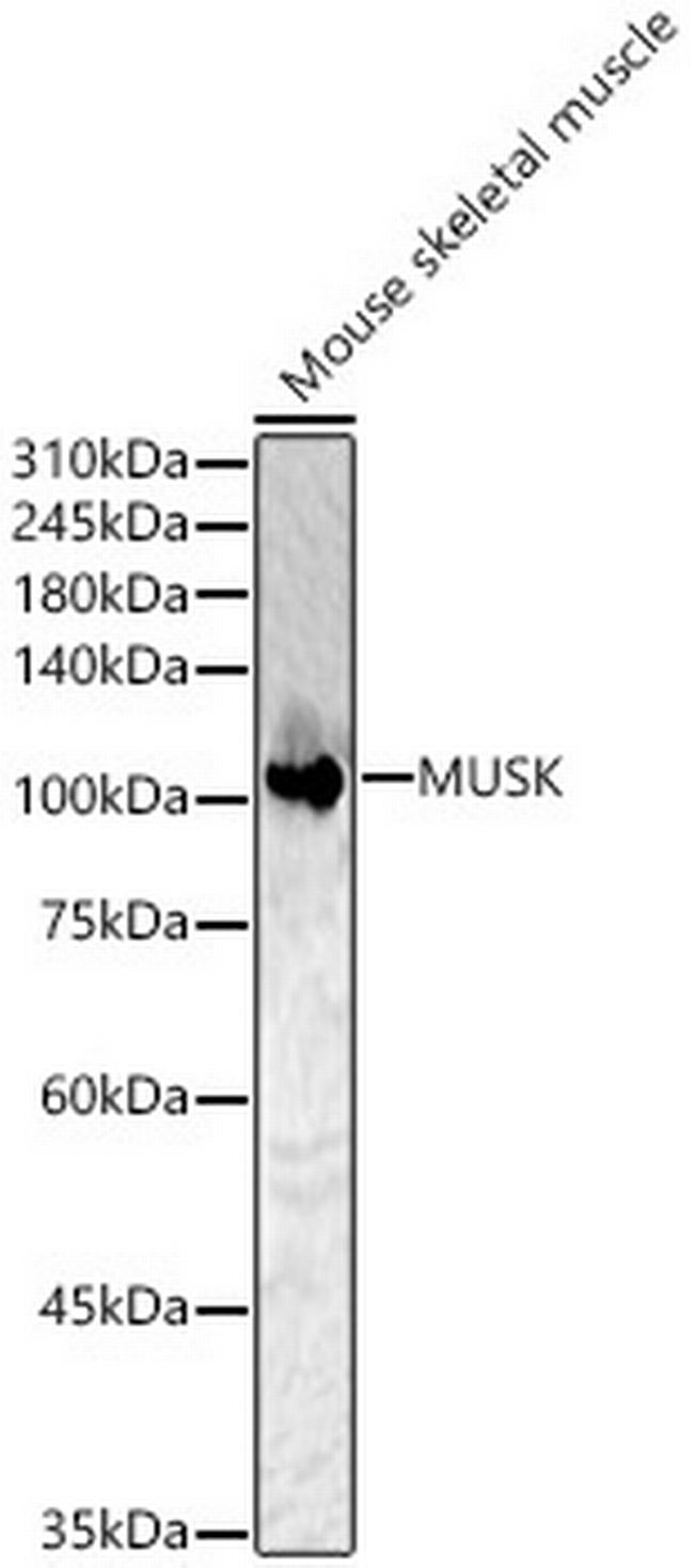 MUSK Antibody in Western Blot (WB)