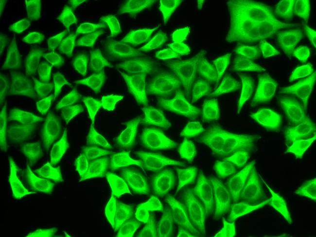 ALDH4A1 Antibody in Immunocytochemistry (ICC/IF)