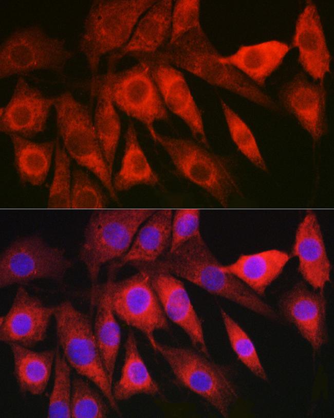 LAMTOR5 Antibody in Immunocytochemistry (ICC/IF)