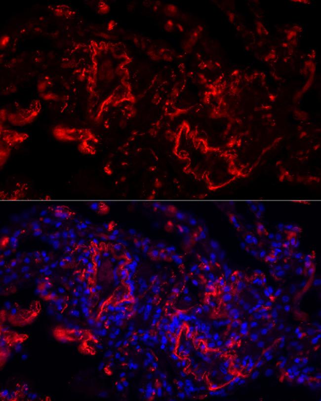 Elastin Antibody in Immunocytochemistry (ICC/IF)