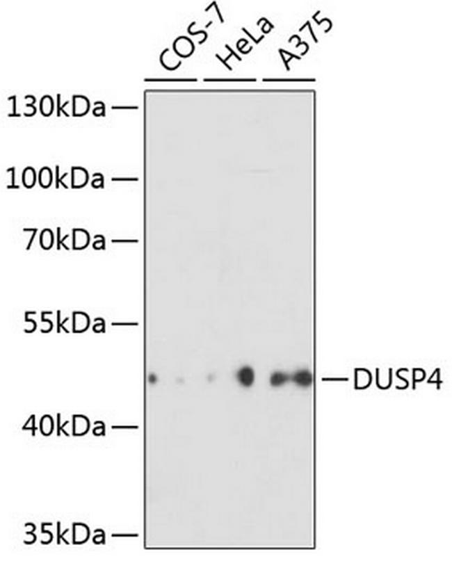 MKP2 Antibody in Western Blot (WB)