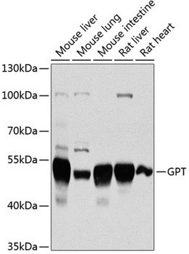 GPT Antibody in Western Blot (WB)