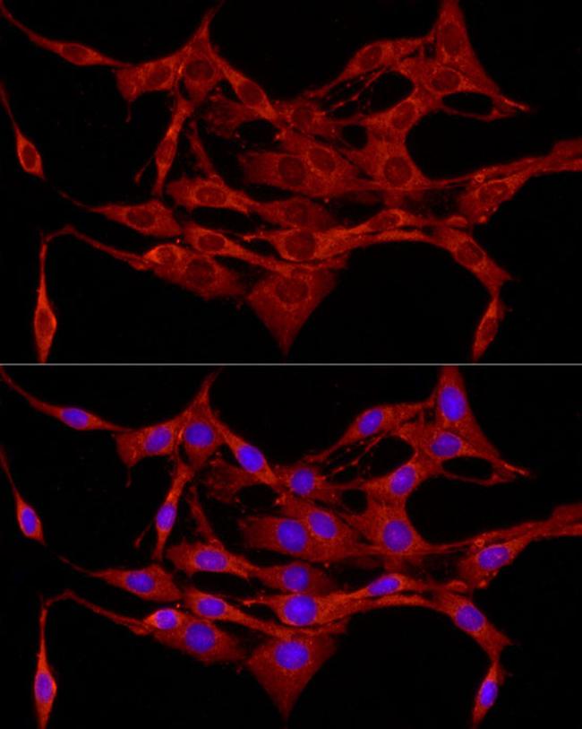 Protein APC Antibody in Immunocytochemistry (ICC/IF)