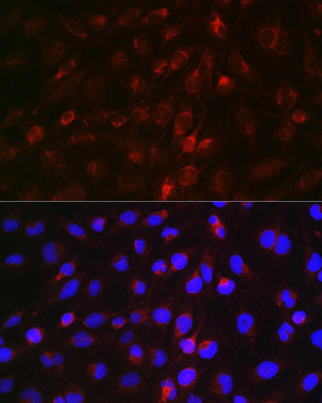 EDA Antibody in Immunocytochemistry (ICC/IF)