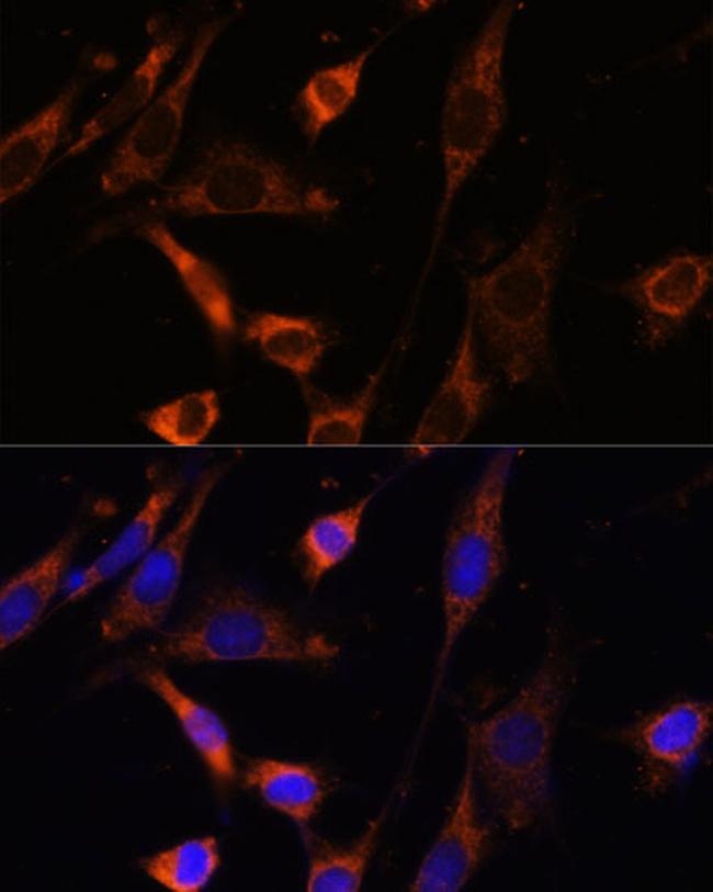 CKMT1B Antibody in Immunocytochemistry (ICC/IF)