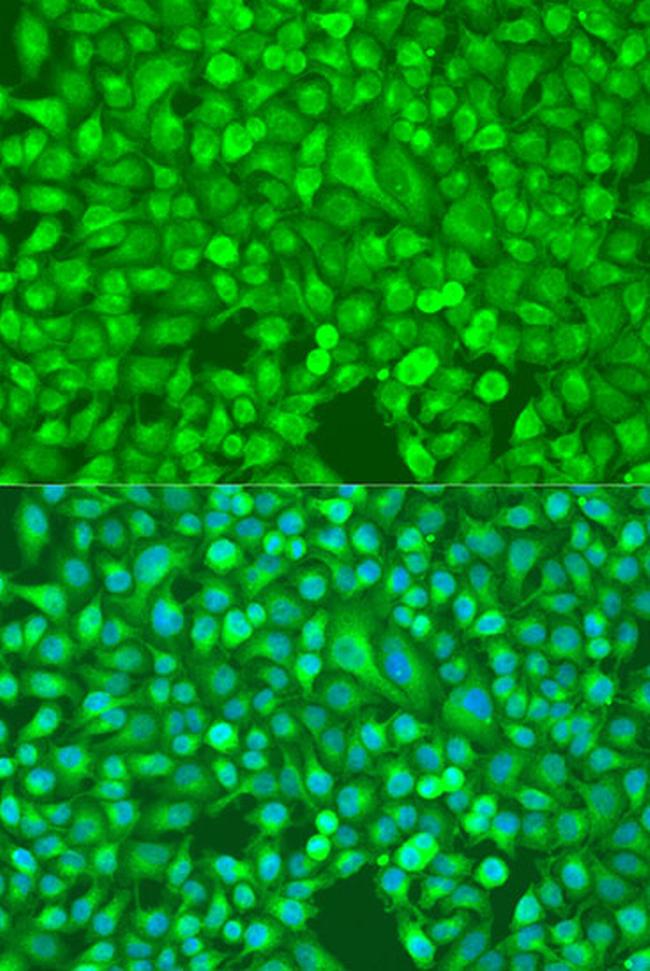 NFkB p100 Antibody in Immunocytochemistry (ICC/IF)