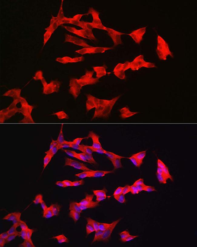 PACAP Receptor Antibody in Immunocytochemistry (ICC/IF)