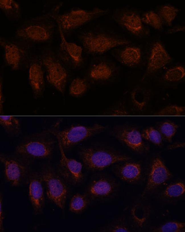 PP2A beta Antibody in Immunocytochemistry (ICC/IF)