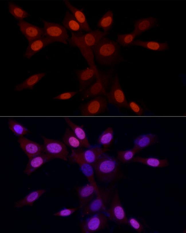 H3R2me2a Antibody in Immunocytochemistry (ICC/IF)