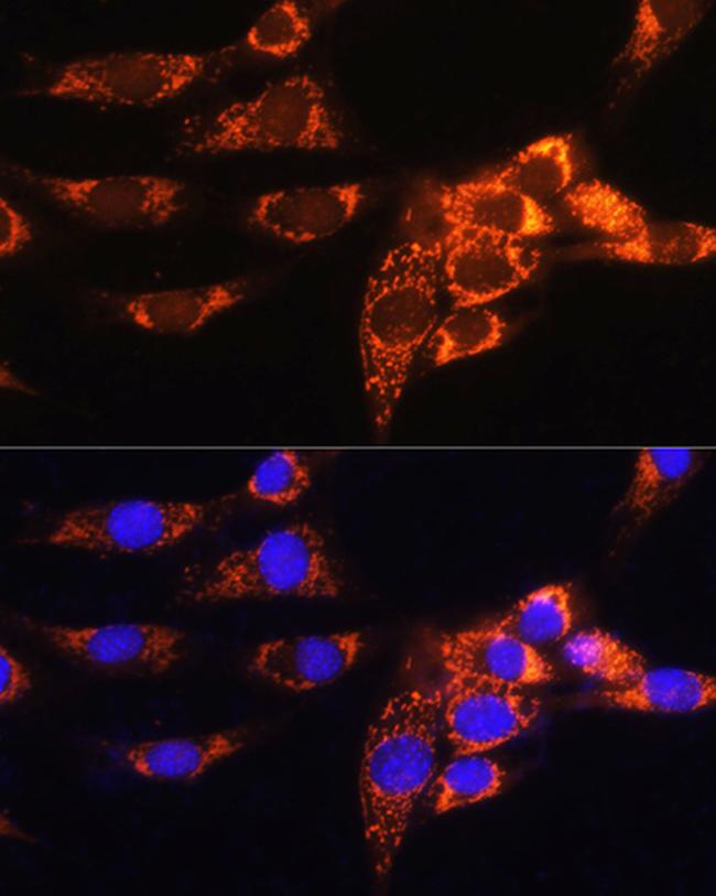 AMPD1 Antibody in Immunocytochemistry (ICC/IF)