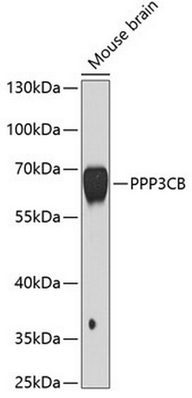 PPP3CB Antibody in Western Blot (WB)