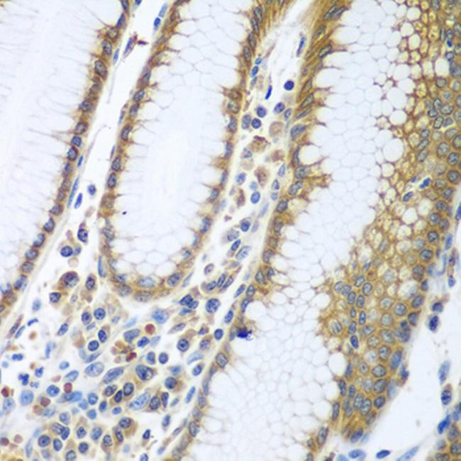 FUT6 Antibody in Immunohistochemistry (Paraffin) (IHC (P))