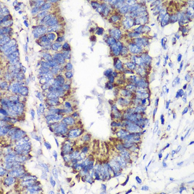 RALB Antibody in Immunohistochemistry (Paraffin) (IHC (P))