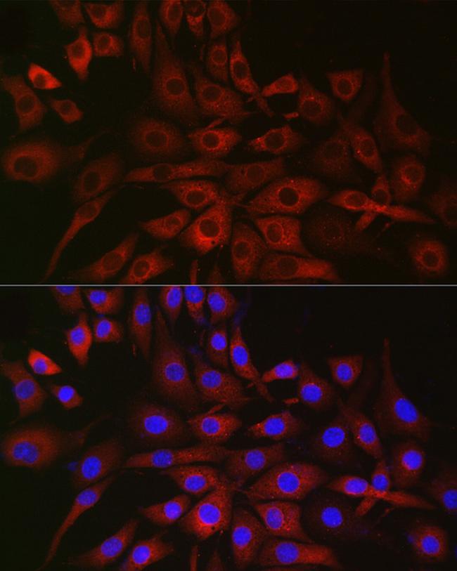 P4HA2 Antibody in Immunocytochemistry (ICC/IF)