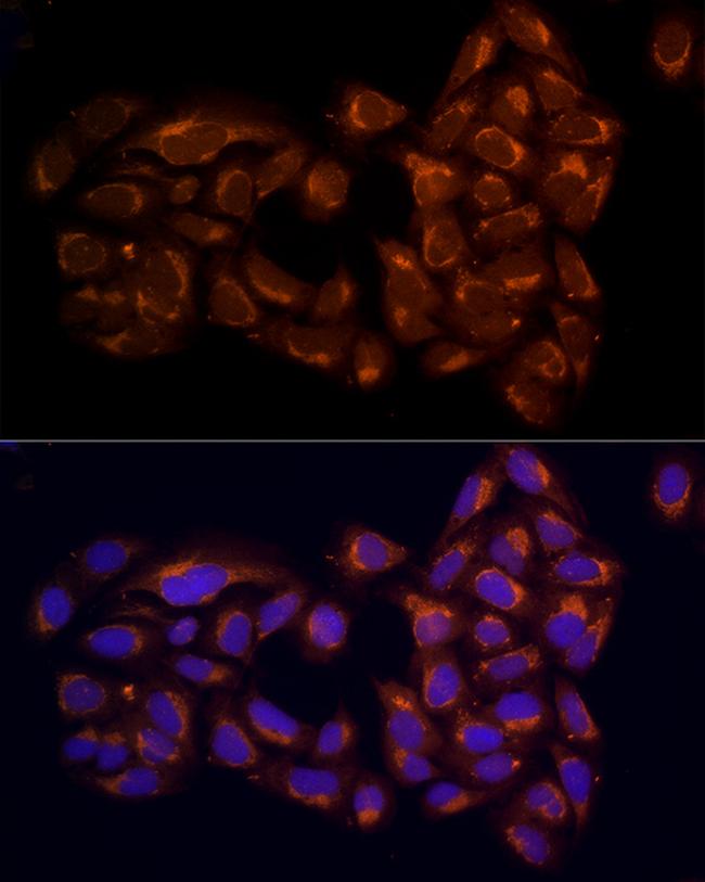 RPH3AL Antibody in Immunocytochemistry (ICC/IF)