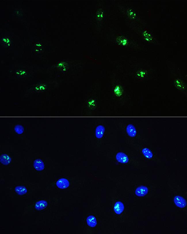 NOP58 Antibody in Immunocytochemistry (ICC/IF)