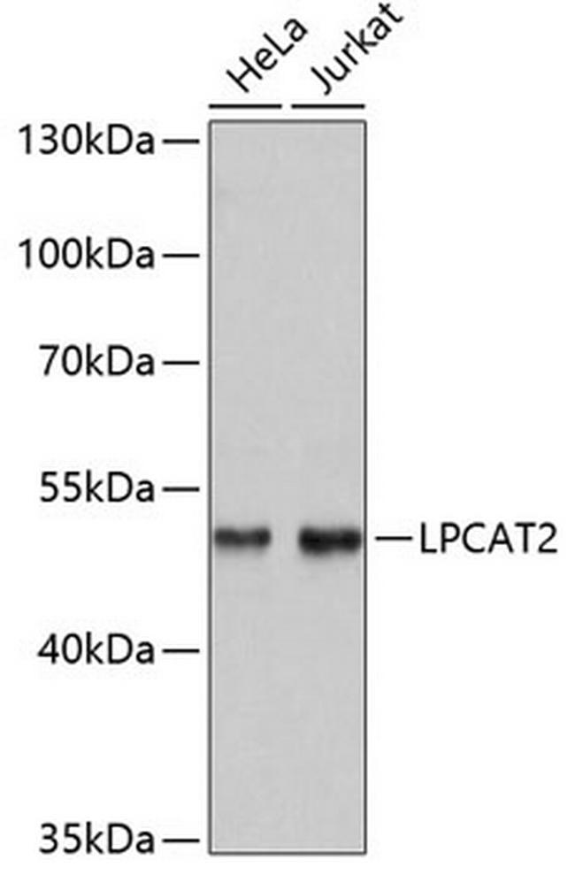 LPCAT2 Antibody in Western Blot (WB)