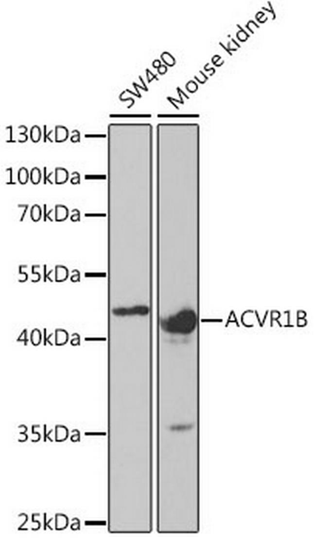 ACVR1B Antibody in Western Blot (WB)