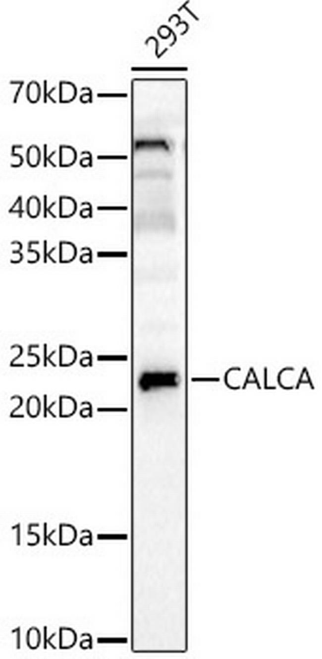 APRT Antibody in Western Blot (WB)