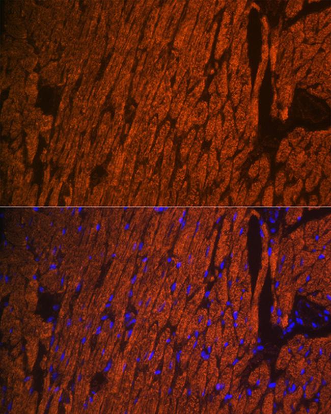 MYL2 Antibody in Immunohistochemistry (Paraffin) (IHC (P))