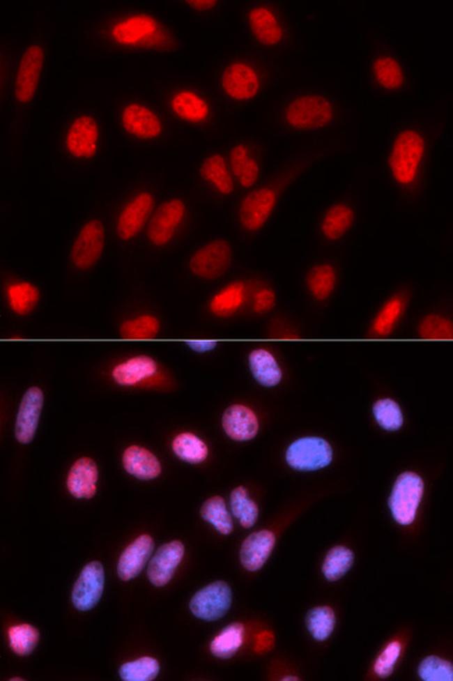 RFC4 Antibody in Immunocytochemistry (ICC/IF)