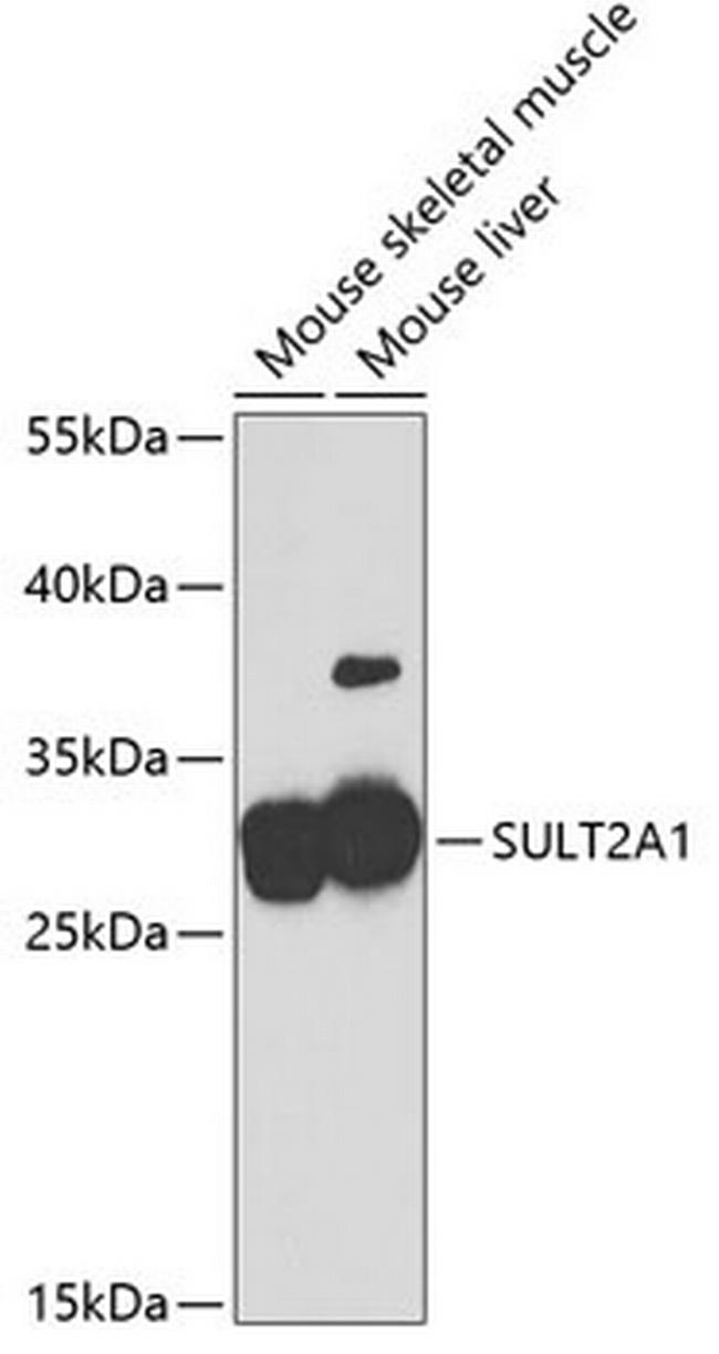 SULT2A1 Antibody in Western Blot (WB)