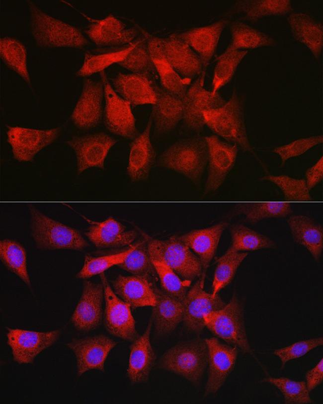 AKT1 Antibody in Immunocytochemistry (ICC/IF)