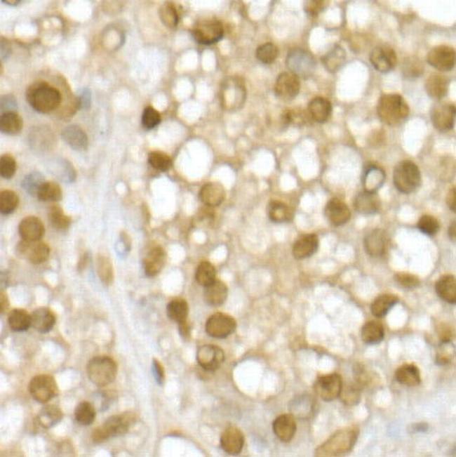 RNF2 Antibody in Immunohistochemistry (Paraffin) (IHC (P))