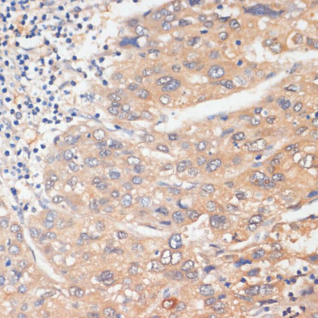 WNK3 Antibody in Immunohistochemistry (Paraffin) (IHC (P))